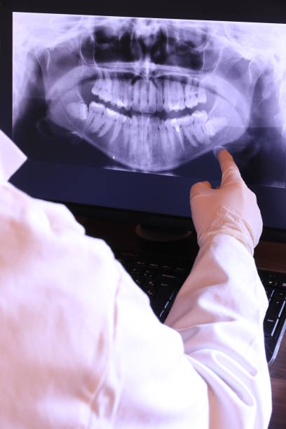 Best Emergency Wisdom Teeth Removal in Mill Creek East, WA